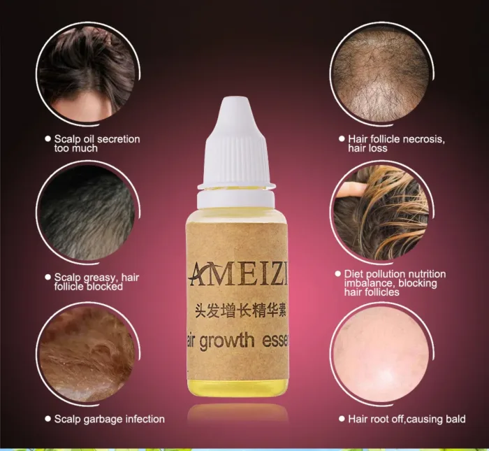 Hair Growth anti Hair Loss Liquid 20ml - Image 5